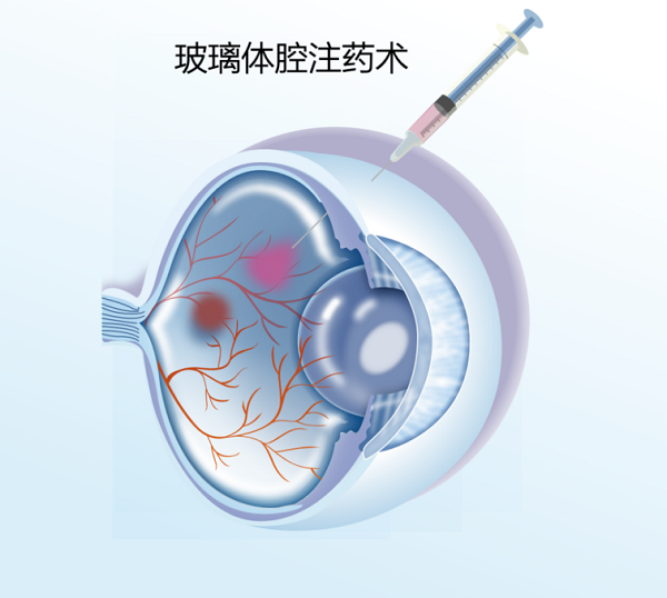 圖片2（網(wǎng)站版）.png