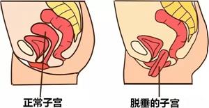 圖片3_副本.png