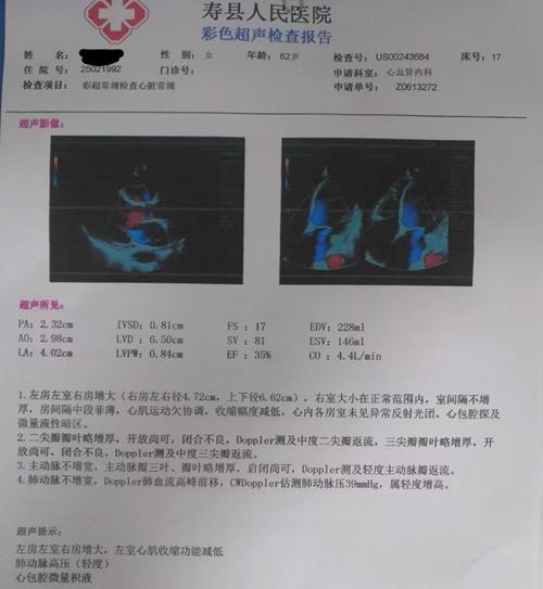 心臟超聲_副本.jpg
